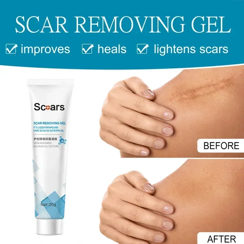 Scar Removal Herbal Cream Repair Stretch Marks Treatment Gel Burn Acne Surgical Acne Scar Ointment Whitening Beauty Health Care