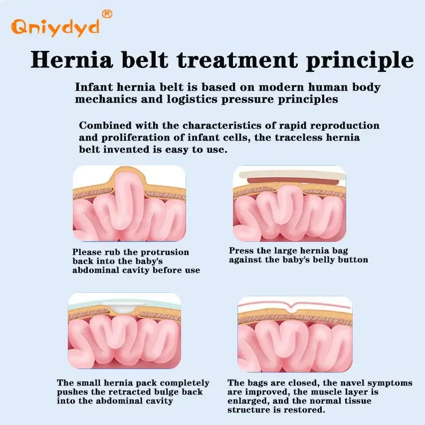 Umbilical Hernia Belt Newborn Baby Umbilical Hernia Belt Infant Navel Support Stickers with 3 Hernia Pads Belly Button Treatment Support