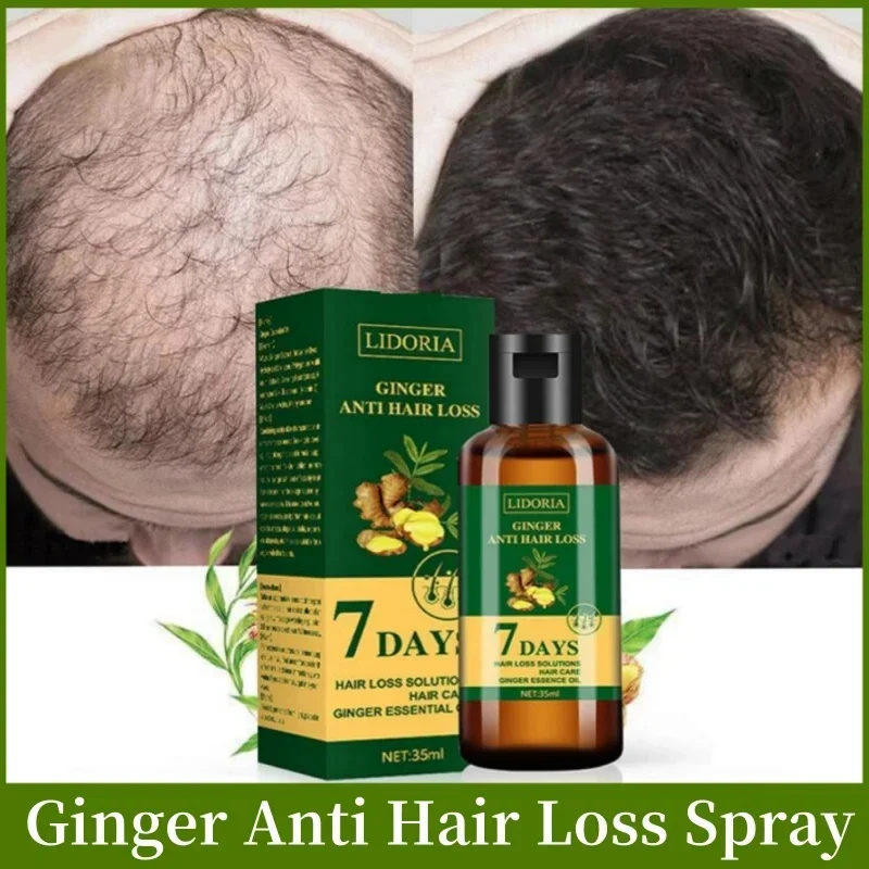 

Ginger Hair Growth Serum Spray Natural Anti Hair Loss Prevent Baldness Essential Oil Scalp Treatment Nourish Hair Care Men Women