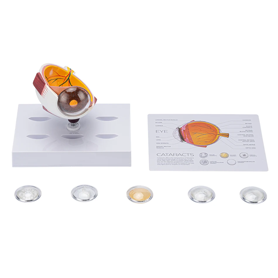 Cornea Eyeball Human Eye Model Demonstration Teaching Prop Cataract Anatomy Medical Teaching Model