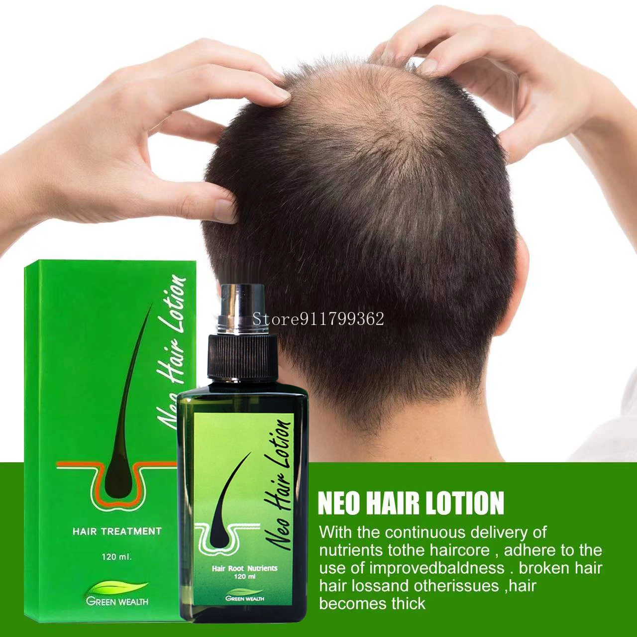 Hair Loss Treatment Growth Hair for Men Women1pcs120ml Neo Hair Lotion Hair  Growth Serum Essence Oil _ - AliExpress Mobile