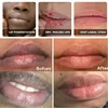 Remove Dark Lip Balm Lightening Melanin Mask Gloss Oil Exfoliating Clean Moisturizer Korean Care Makeup Beauty Health Products 2