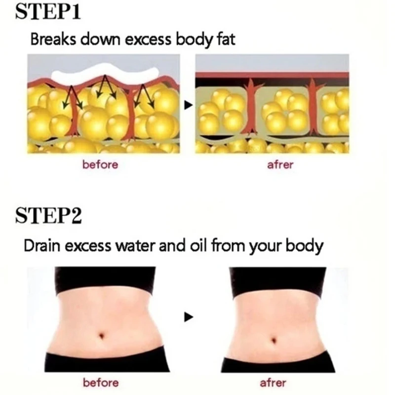 Burn Fat Chinese Medicine Slimming Patches fat burning Natural Detox men and women weight loss products