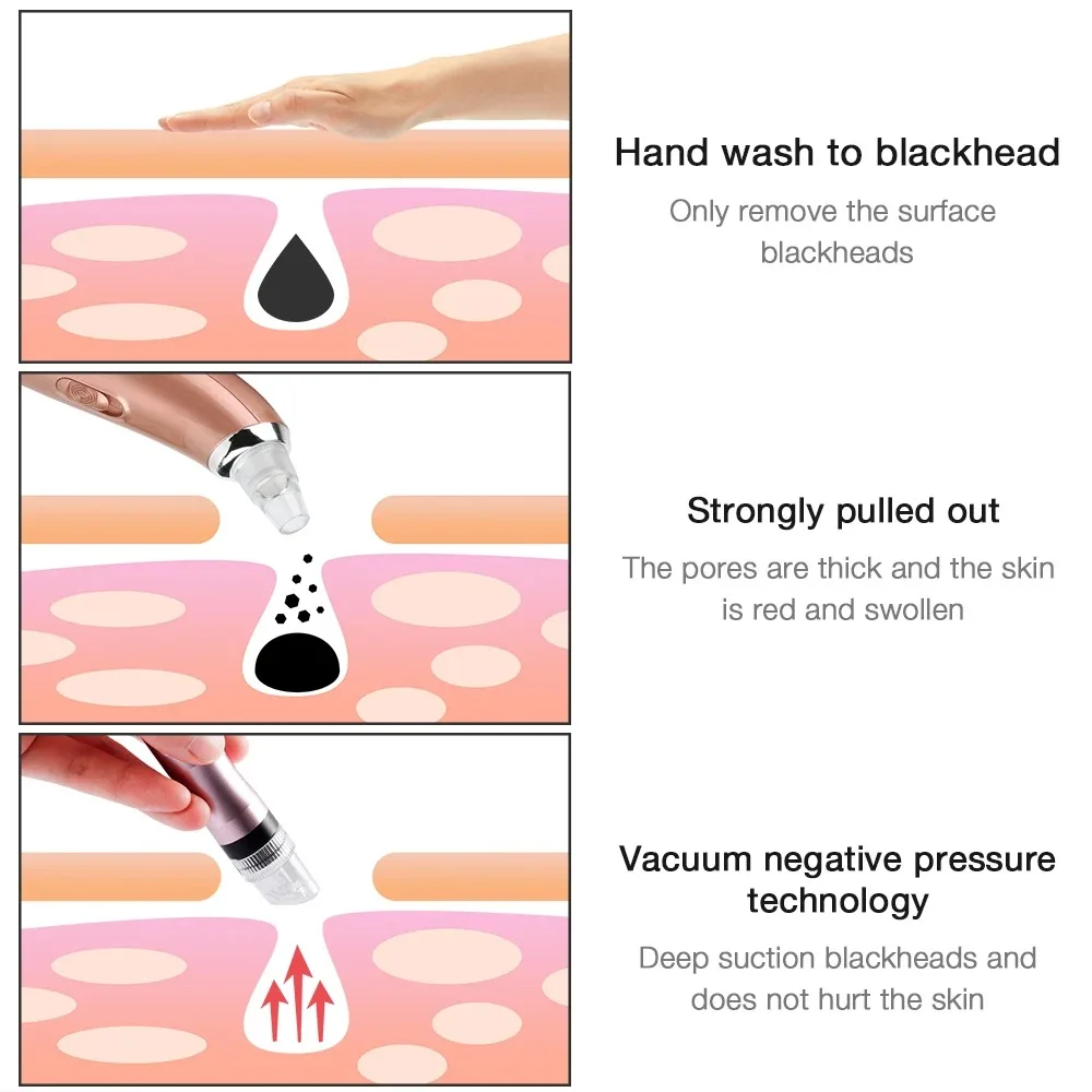 Small Bubble Facial Bubble Beauty Device Blackhead Pore Cleaner Hydrogen Water Oxygen Spray Vacuum Injection Clean Hydra Dermabrasion Device,facial bubble beauty device,blackhead pore cleaner