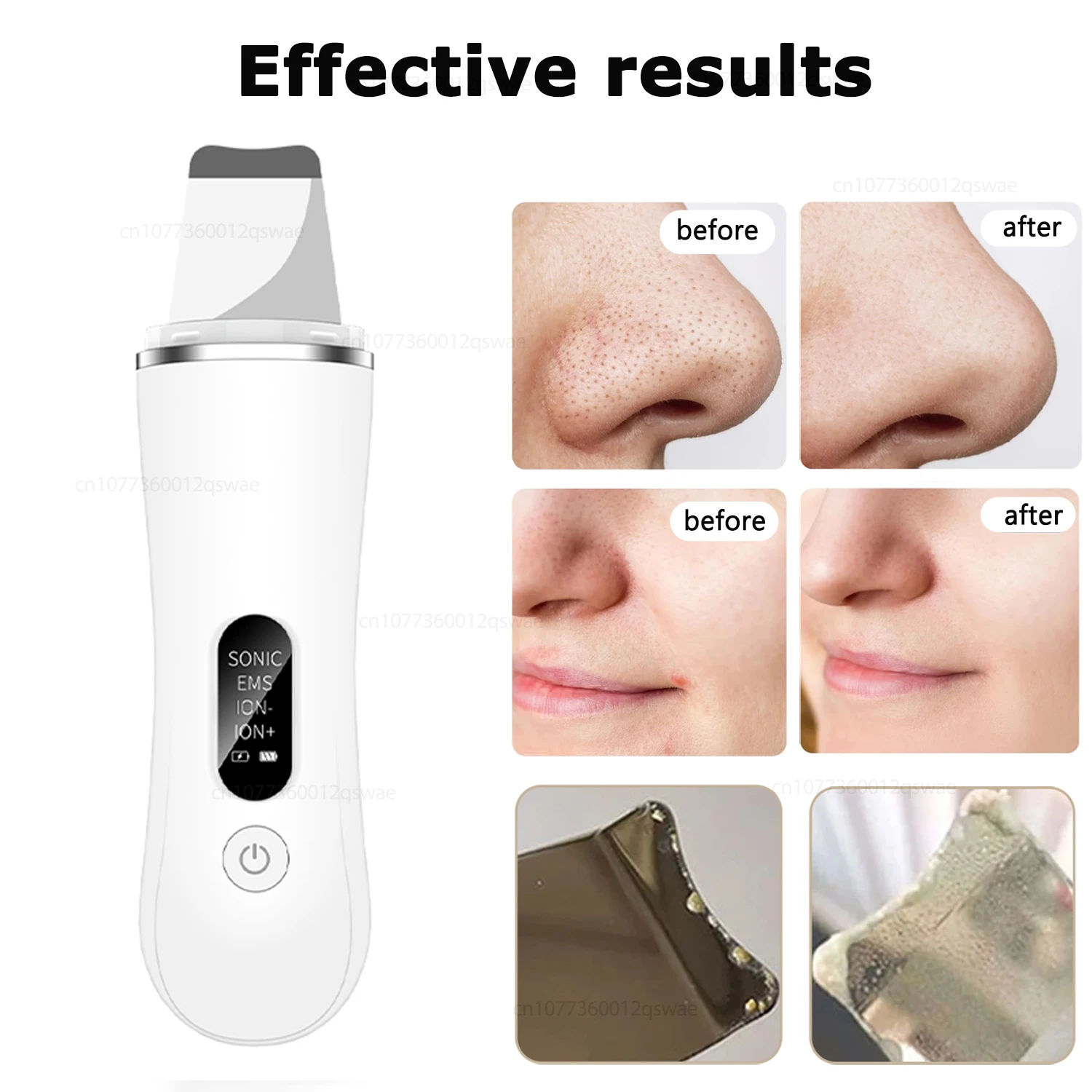 Ultrasonic Skin Scrubber Peeling Blackhead Remover Deep Face Cleaning Acne Pore Cleaner Facial Shovel Cleanser Face Scrubber