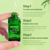BREYLEE Acne Treatment Serum Facial Essence Liquid Shrink Pores   Acne Removal Repair Serum17ml 3