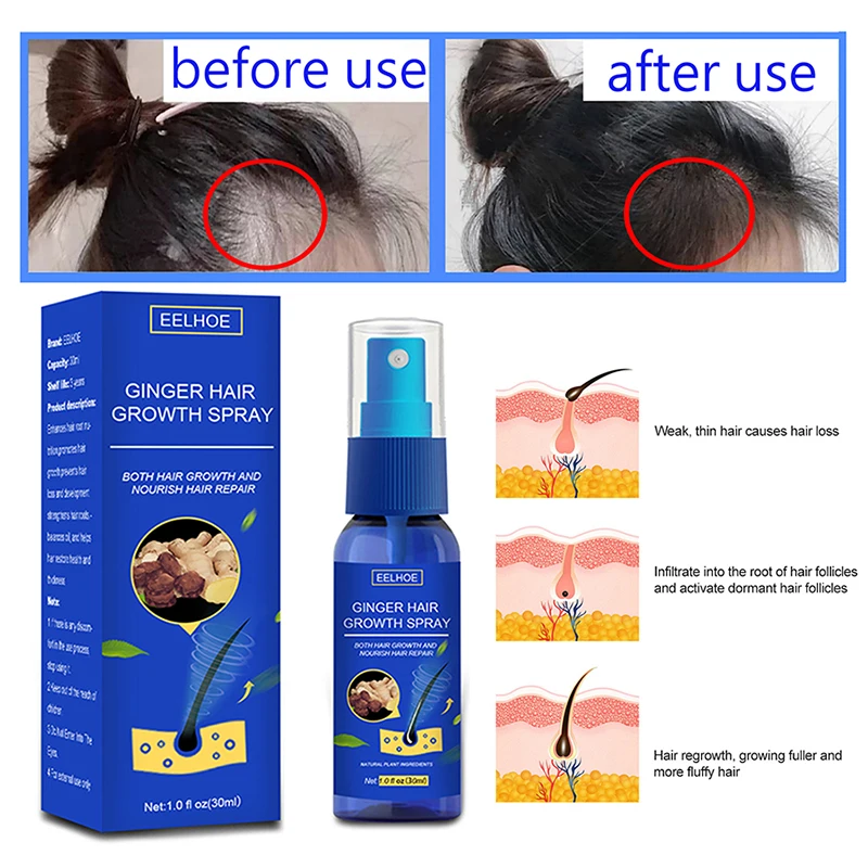 

EELHOE Ginger Hair Growth Spray Serum Anti Hair Loss Products Fast Grow Prevent Hair Dry Frizzy Damaged Thinning Repair Care