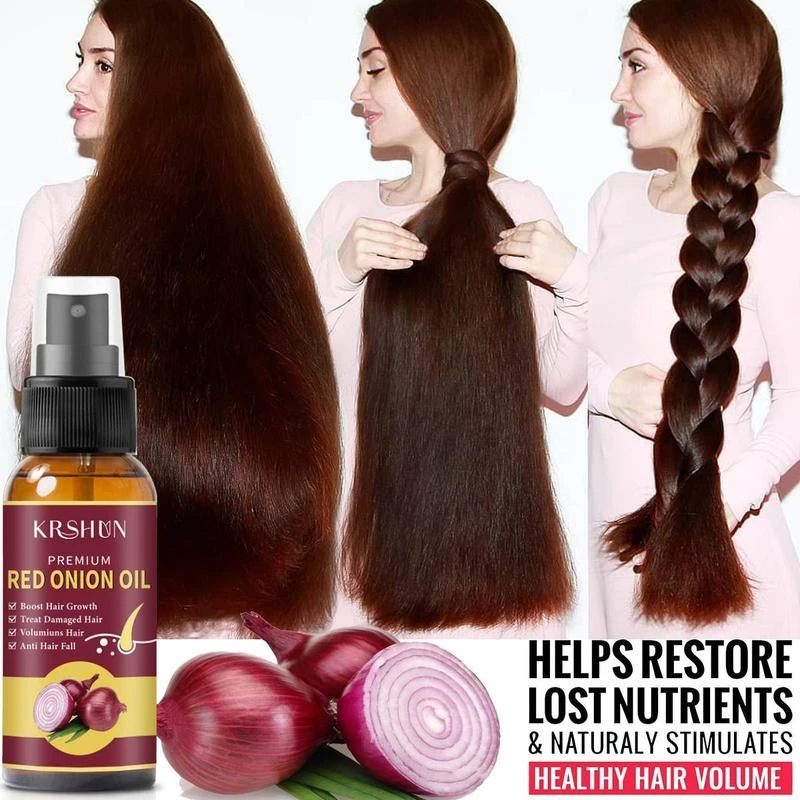 Onion Black Seed Hair Oil Spray For Natural Hair Care And Growth Prevent  Hair Loss Biotin Fast Hair Growth - Hair Loss Product Series - AliExpress