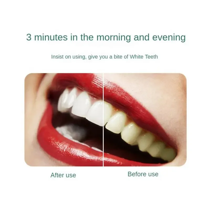 1PCToothpaste Quickly Repair Gums Decay Cavities Caries Protect Teeth Whitening Toothpaste To Remove Plaque Eliminate Bad Breath
