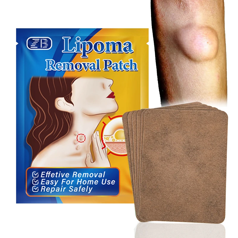 Lipoma Patch 6Pcs