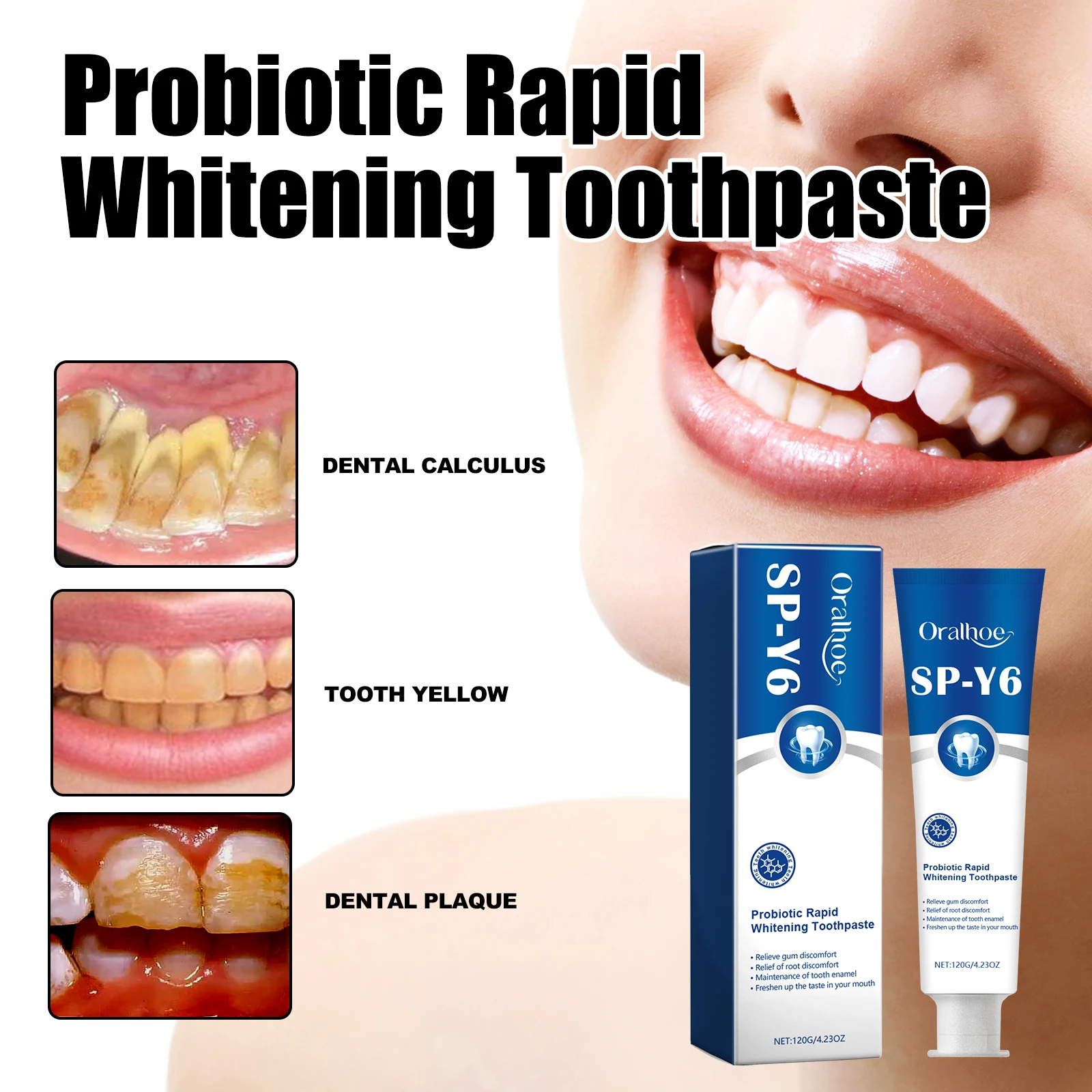 Oralhoe probiotic whitening toothpaste,Oral cleaner,Tooth Color Correction,Care For Oral Health Teeth Whitening Toothpaste
