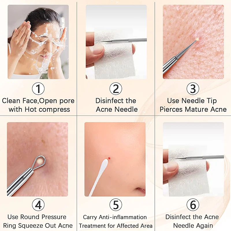 Blackhead Removal Kit Image 6