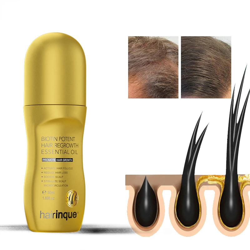 

Vitamin B7 Hair Growth Products Prevent Hair Loss Serum Scalp Treatments Growing Hair Care Oil for Men Beauty Health