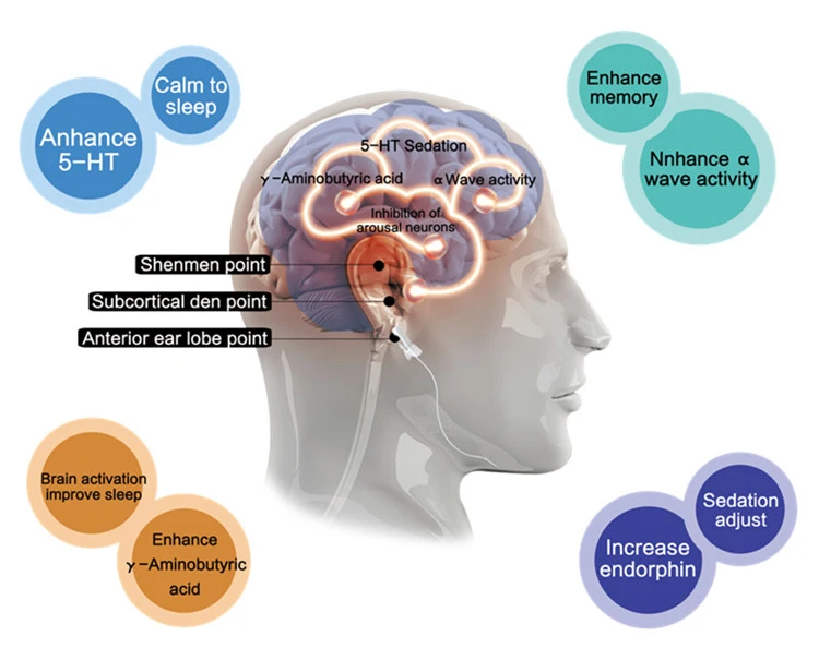 Ansia Depressione Sollievo Impulso Alpha-Stim Tens Fisioterapia Ces Microcorrente Terapia Insonnia Dispositivo Di Aiuto Per Il Sonno