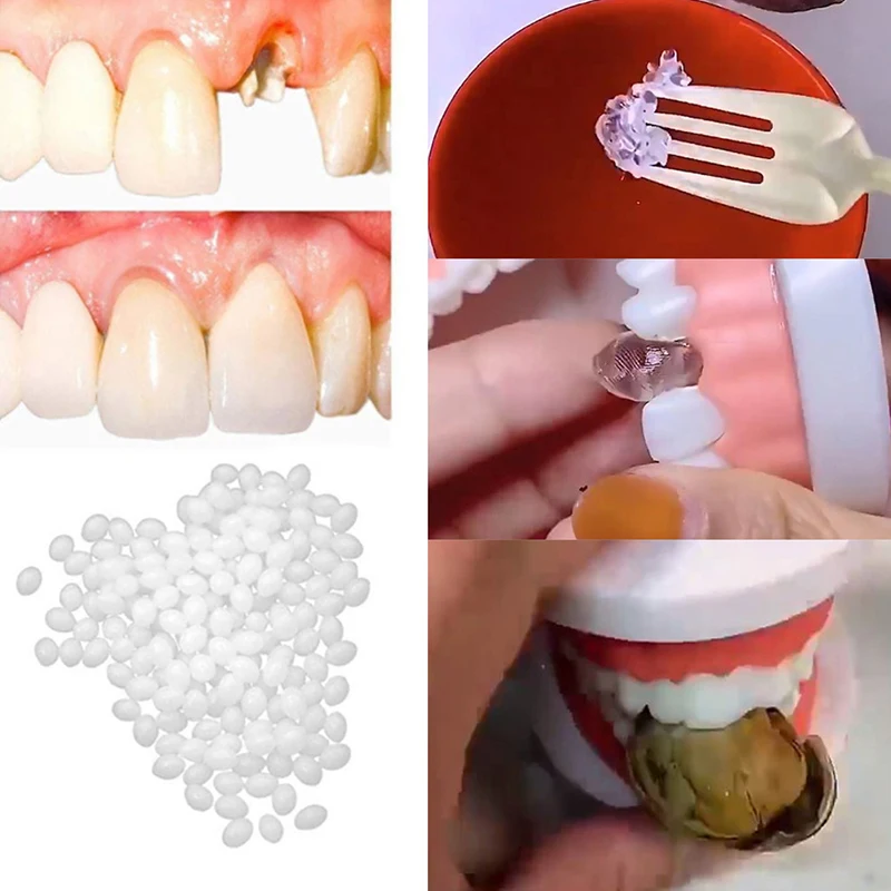 100G Temporary Tooth Repair Kit Thermal Beads Solid Glue Temporary