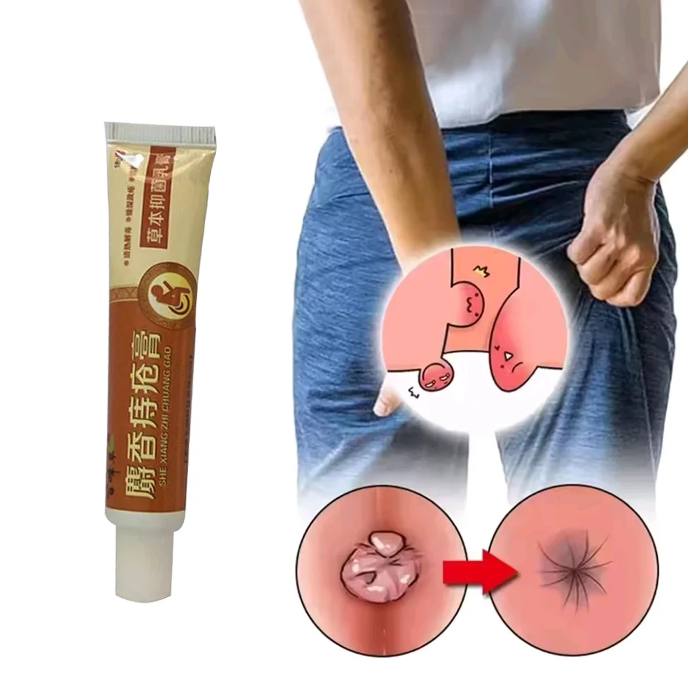 Musk Materials Hemorrhoids Ointment 18g Powerful Hemorrhoids Cream Internal Piles External Anal