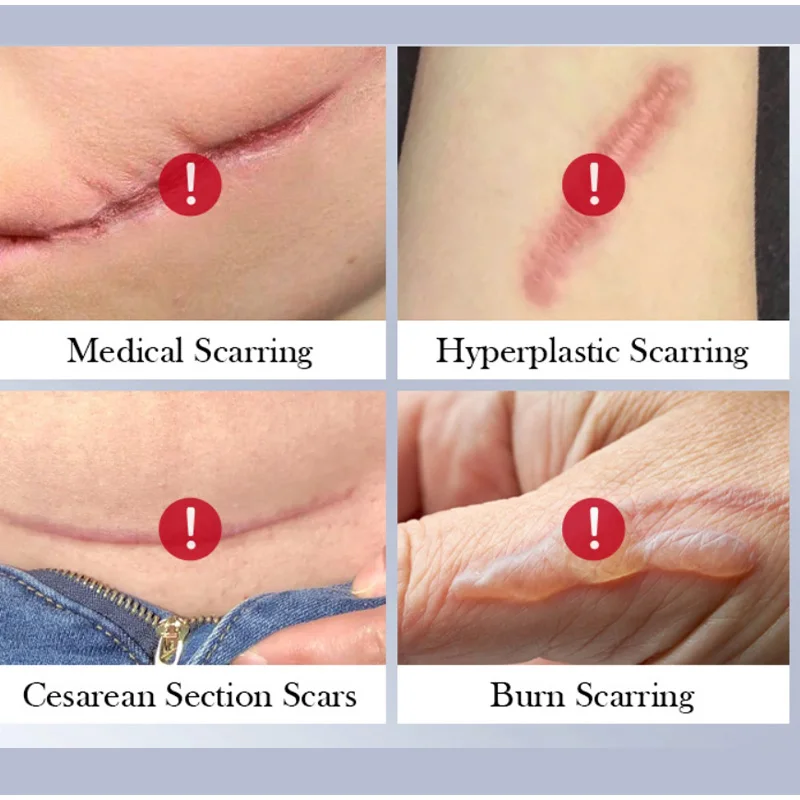 Scar Repair Cream - Moisturizing Rejuvenating Facial Skin Care for Women