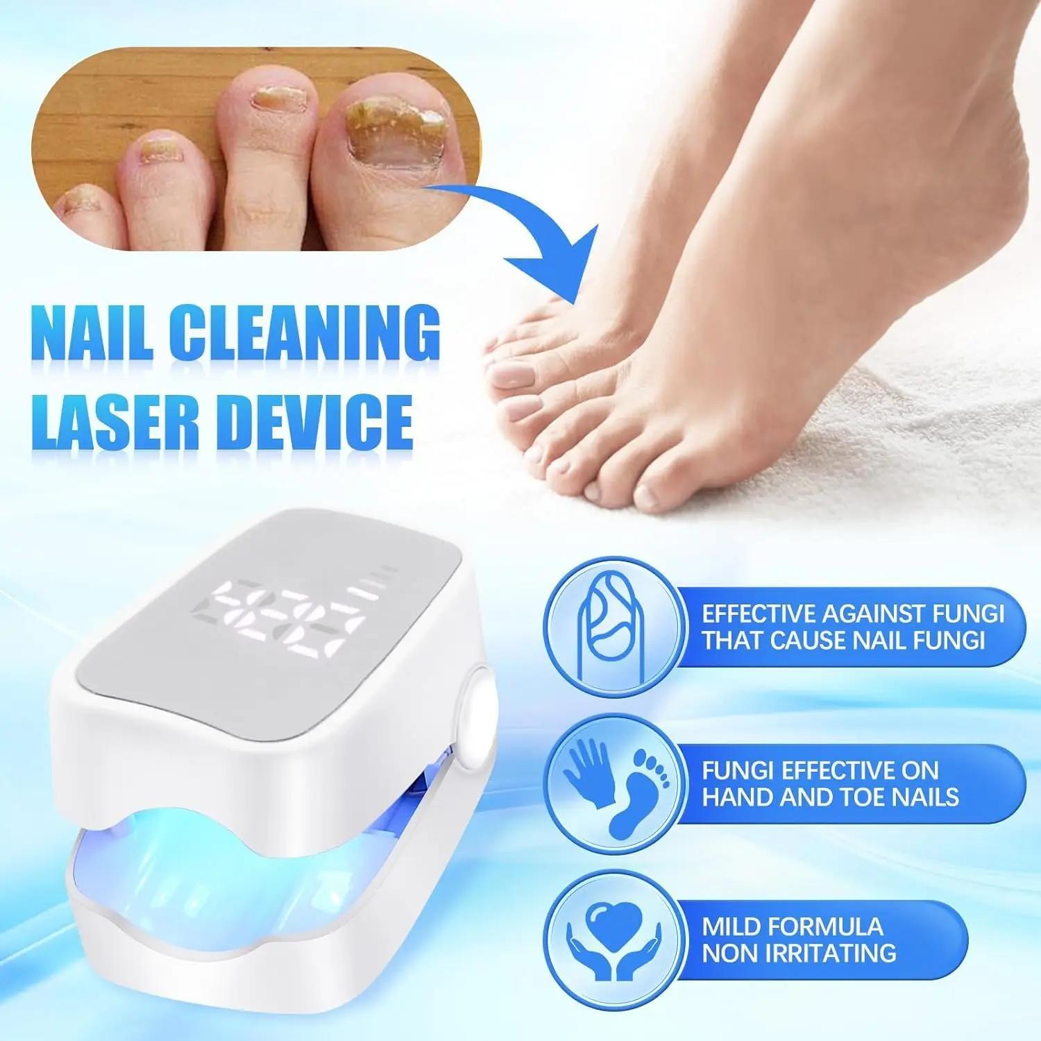 Nail Fungus Remover Personal Health Care Laser Therapy Pen Nail Fungus Laser Device with Time Display 470nm950nm wavelength for Finger/Toenails