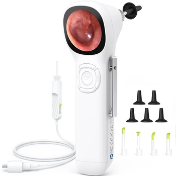 Otoscopio digitale SA160 Schermo IPS Otoscopio video intelligente HD con luce, otoscopio per orecchio con fotocamera per rimozione cerume