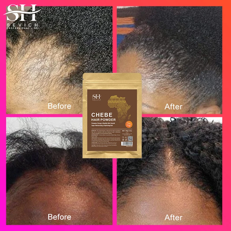 Sevich Chebe Powder Effective Growthing Hair Improves Hair Density Nourishes Follicles Fast Regrowth Product 100g