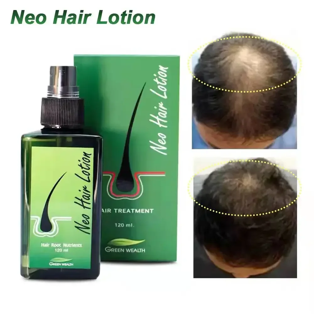 120ml Thailand Hair Growth Essential Oil Spray For Men Woman Hair Growth Anti Loss Perfume Neo Lotion hair growth serum hair growth spray hair care oil hair growth cream