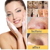 Kojic Acid Glow Soap Facial Deep Cleaning Even Skin Tone Skin Lightening Soap Oil Control Moisturizing women Skin Care 65g x2 2
