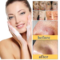 Kojic Acid Glow Soap Facial Deep Cleaning Even Skin Tone Skin Lightening Soap Oil Control Moisturizing women Skin Care 65g x2 2