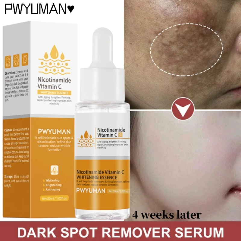 Vitamin C Serum Face Whiten Freckle Dark Spot Stain Remover Cream Niacinamide Lighten Melasma Melanin Blemish Brighten Skin Care