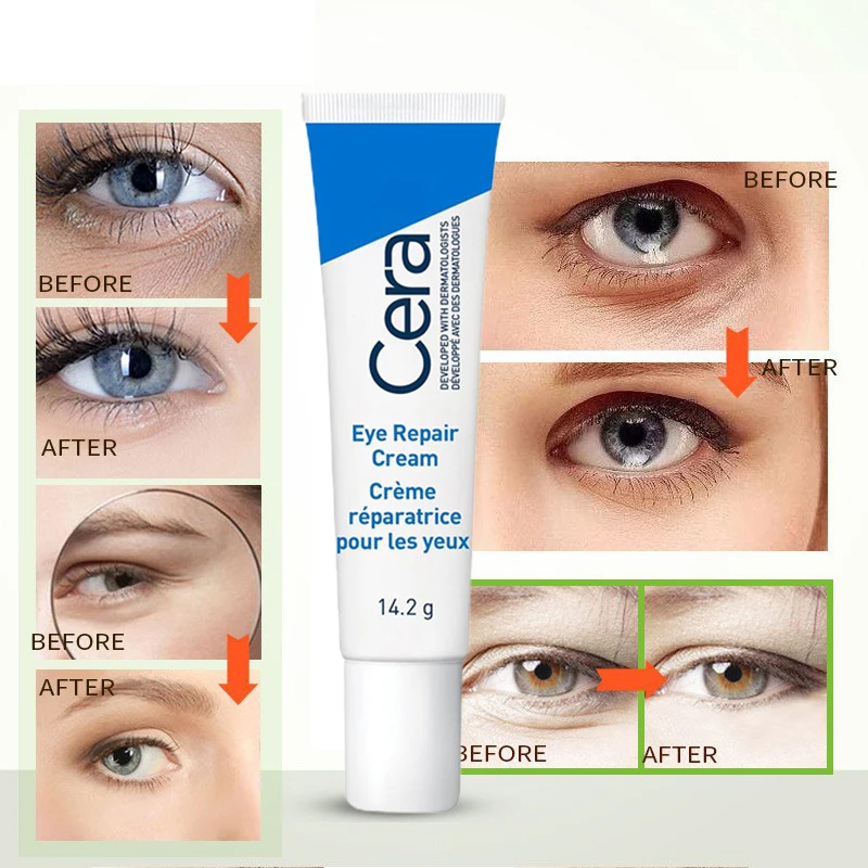 Sdf8289fa41e749709ff53859da76ccfcW Retinol Eye Cream Remover Dark Circles Eye Bags Anti-Wrinkle Anti-Puffiness Reduces Fine Lines Moisturizing Eye Skin Care