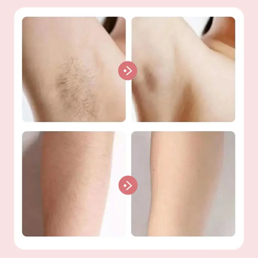 여성용 듀얼 헤드 바디 헤어 트리머, USB 충전식 전기 제모기, 얼굴 바디 비키니 부위용 방수 제모 장치