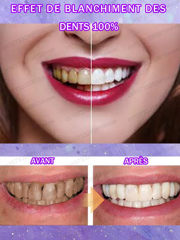 Teeth whitening anti-cavity tooth decay fresh bad breath repair tooth decay remove plaque toothache relieve periodontitis