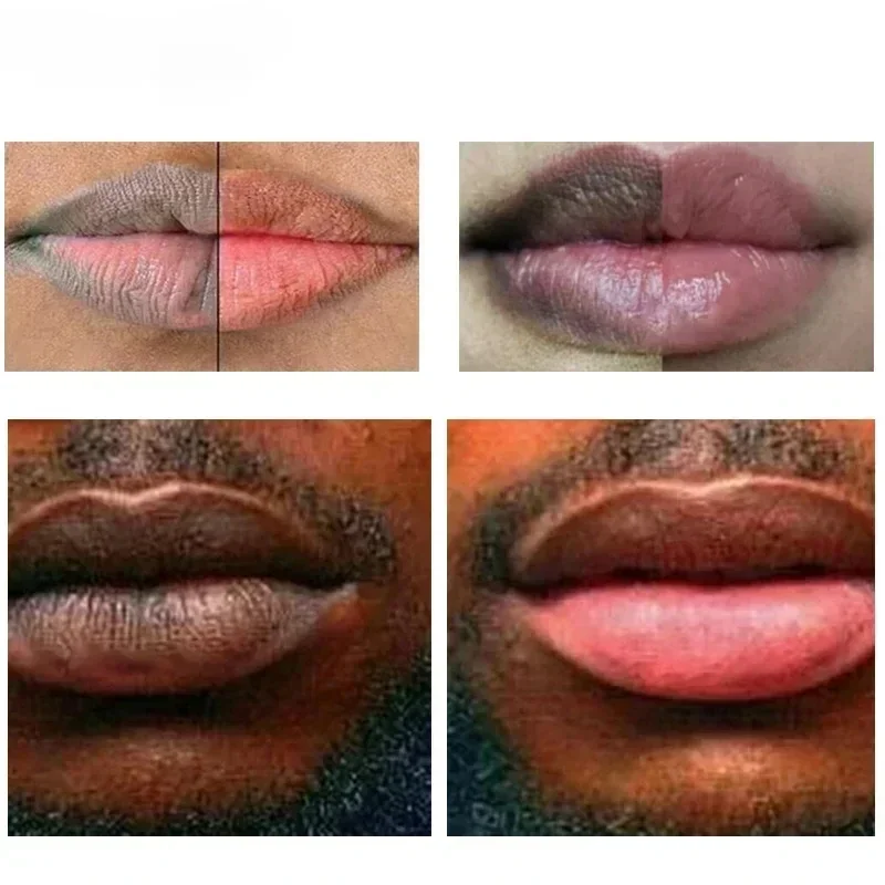Fast Lightening Pink Mouth Lips Serum Bleaching Permanent Pinkish Moisturizing Lighten Dark Lip Balm Gloss Lipstick Lip Mask 2