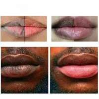 Fast Lightening Pink Mouth Lips Serum Bleaching Permanent Pinkish Moisturizing Lighten Dark Lip Balm Gloss Lipstick Lip Mask 2
