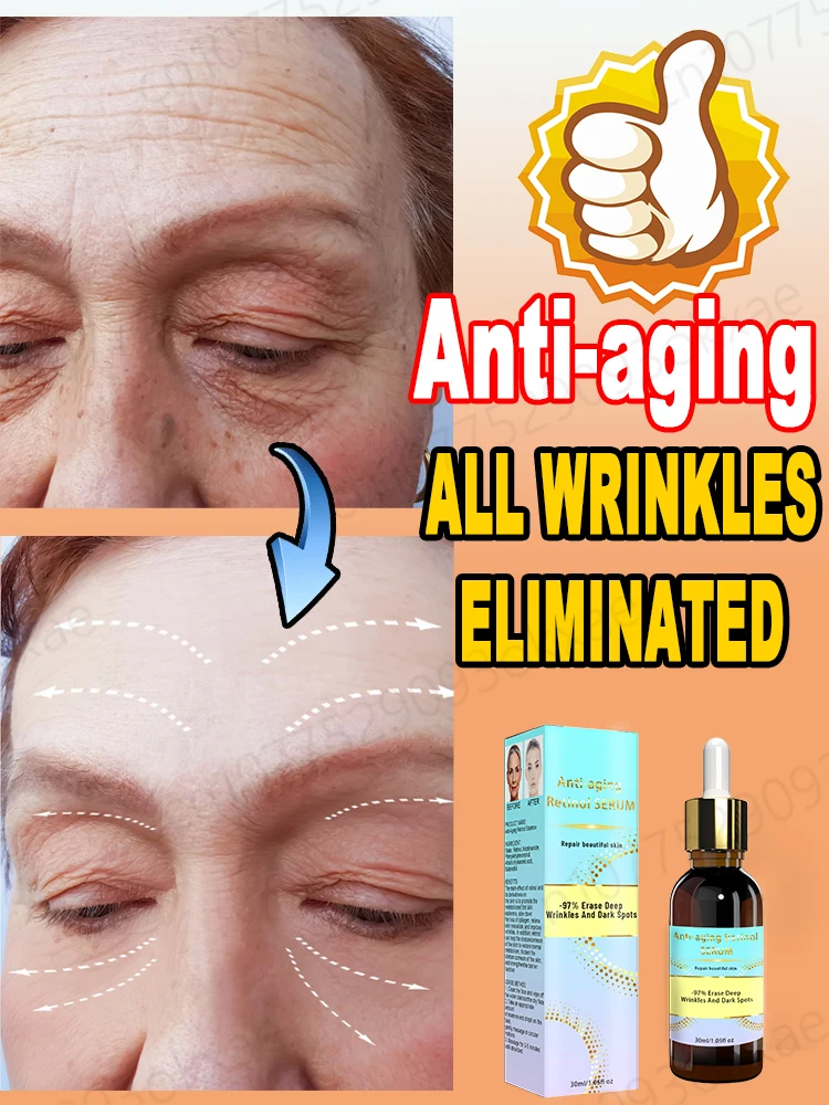 

Anti-aging essence removes wrinkles, tightens facial oil, controls anti-wrinkle, moisturizing and whitening products