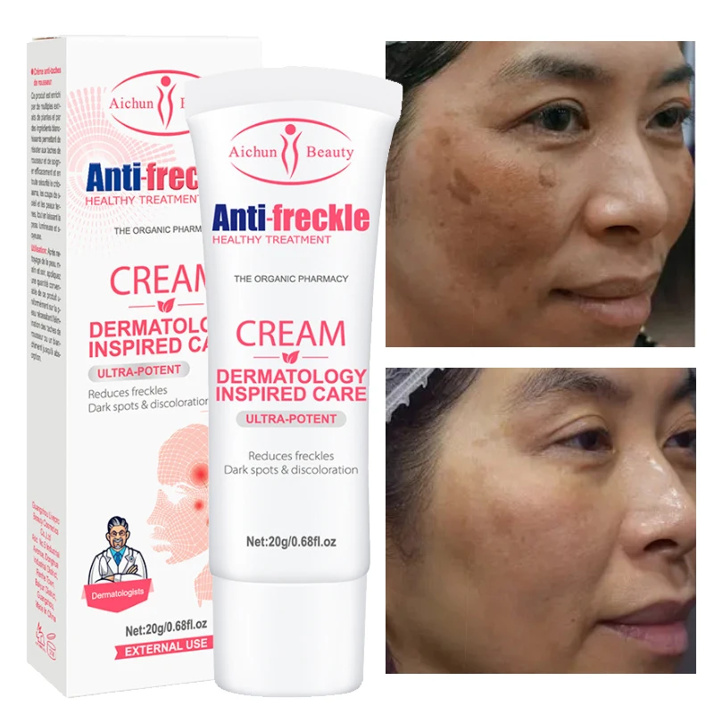 

Никотинамид, крем для лица с веснушками, подтягивающий, укрепляющий, омолаживающий, выцветающий, тонкие линии, товары для подтяжки, гладкая фотопроцедура, уход за красотой 20 г