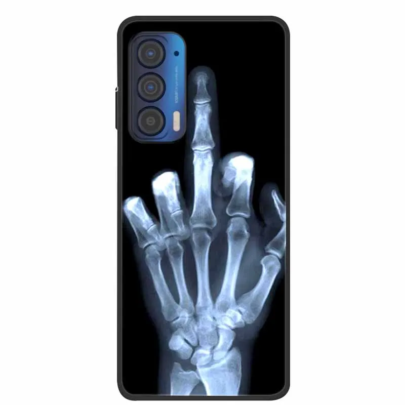 Silicone Soft Flower Marble TPU Black Phone Cover - Protective Case