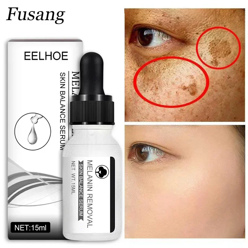 

Whitening Freckle Serum Effective Remove Melasma Cream Lightening Dark Spots Essence Moisturize Brighten Smooth Face Skin Care