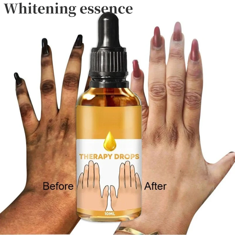 

Dark Knuckles Fast Whitening Serum Black Skin Pigmentation Correctors Hand Knuckle Elbows Knee Intense Stains Remover Essence