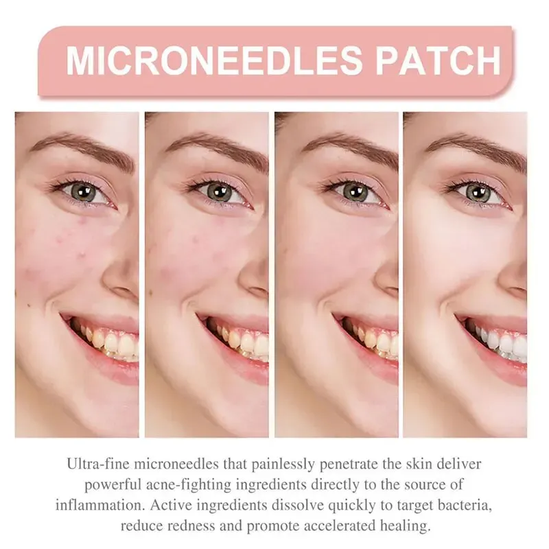 72pcs Patches Comedo Look Invisible Concealer Breathable Covering Patch Facial oil blotting paper