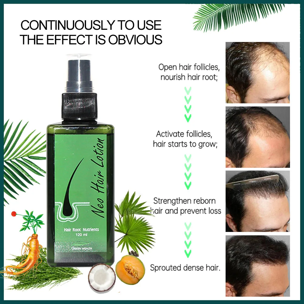 Neo Hair Lotion 120ml Hair Care Root Anti-Loss Beard Regrowth Original Thailand hair growth serum hair growth spray hair growth cream