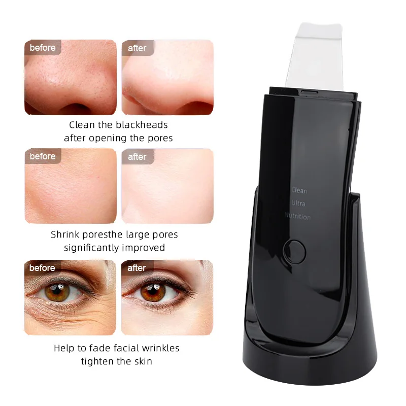 

Wireless Ultrasonic Face Scrubber Exfoliator Blackhead Remover Deep Cleanser Vibrating Facial Scraper Cleansing Spatula Veya