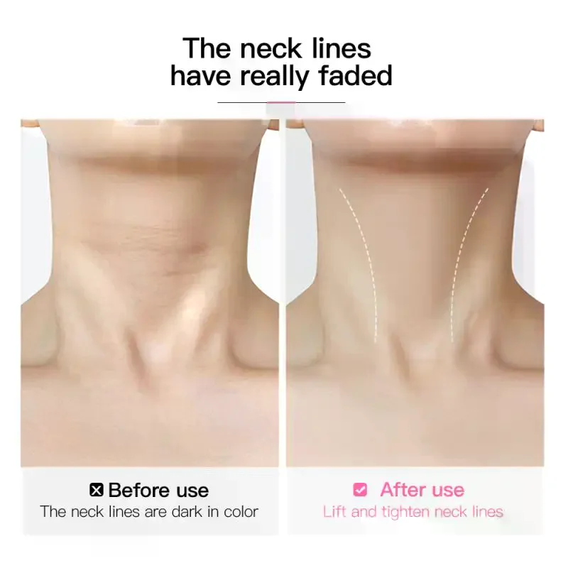 10Pcs 페이스 리프트 테이프 탄성 밴드 넥 리프팅 패치 방수 탄력성 보이지 않는 페이딩 넥 주름 접착 스티커