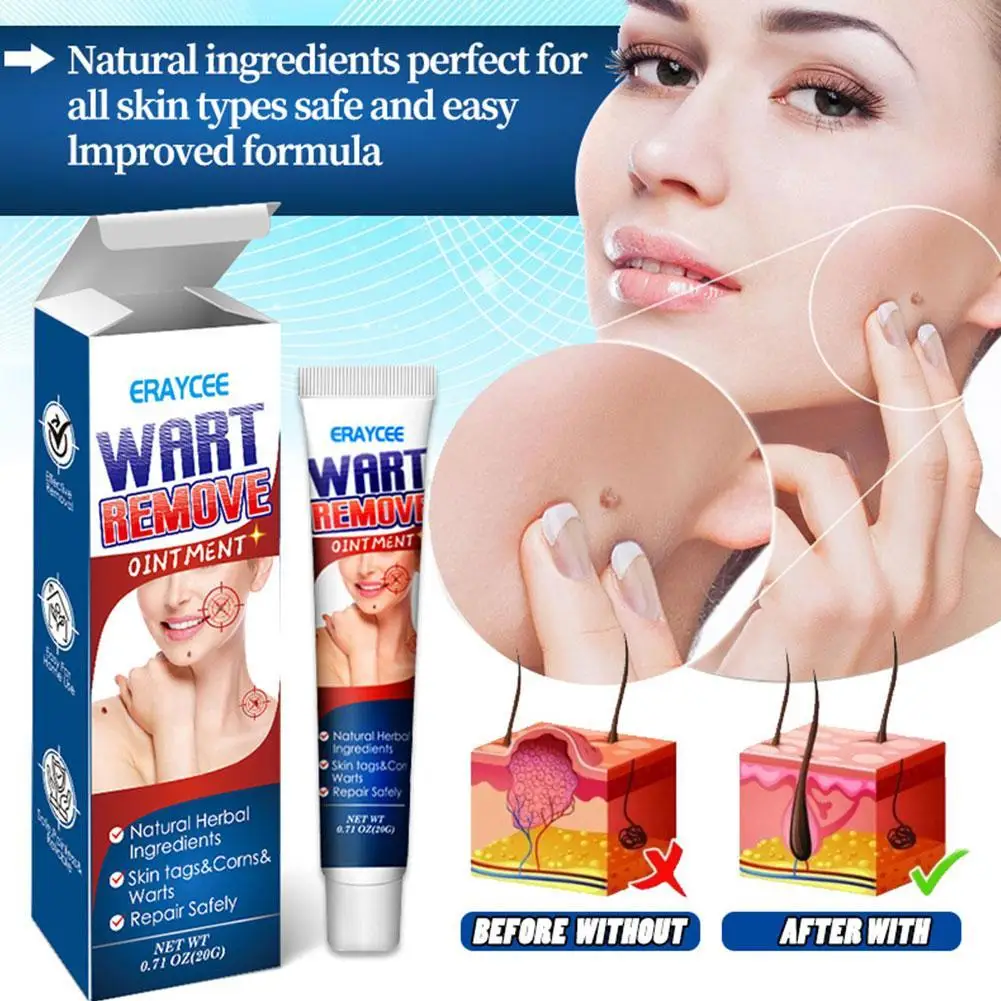 

Skin Tag Warts Remover Antibacterial Ointment Wart Treatment Cream Skin Tag Remover Herbal Extract Corn Plaster Warts Ointment