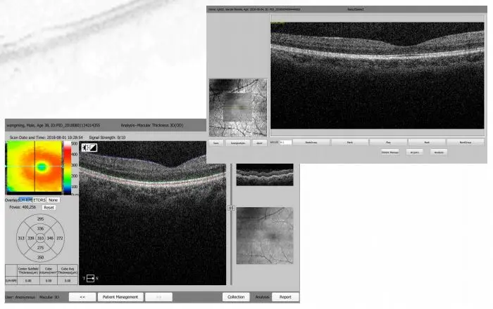 Рисунок 2 - Фотометрия, офтальмологическая