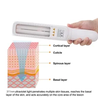 311NM psoriasis Ultraviolet Physiotherapy Instrument Psoriasis Therapy Device White Spot Treatment Light Home Physiotherapy 2