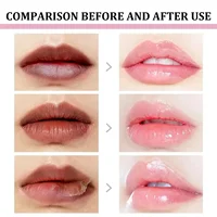 Baume éclaircissant pour les lèvres, masque anti-mélanine, huile brillante, exfoliant, nettoyant, hydratant, produits de soin coréens, maquillage, beauté, santé 3