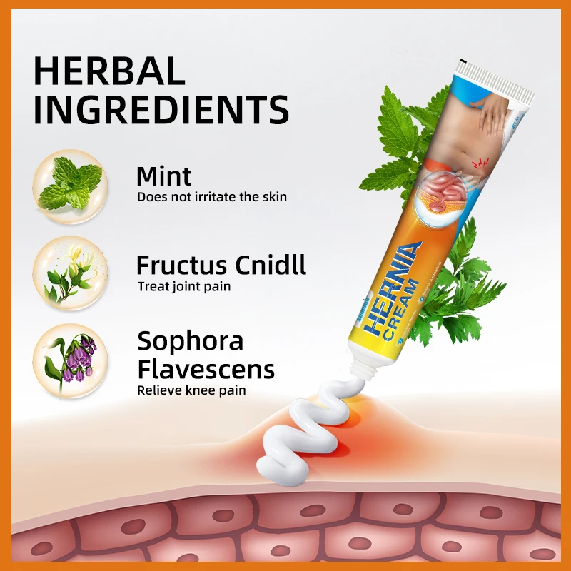 20g Sumifun Hernia Treatment Cream Inguinal Umbilical Femoral Abdominal Wall Hernia Medical Ointment Rupture Colic Relief Cream Pain Relief Cream Hemorrhoids Treatment Cream