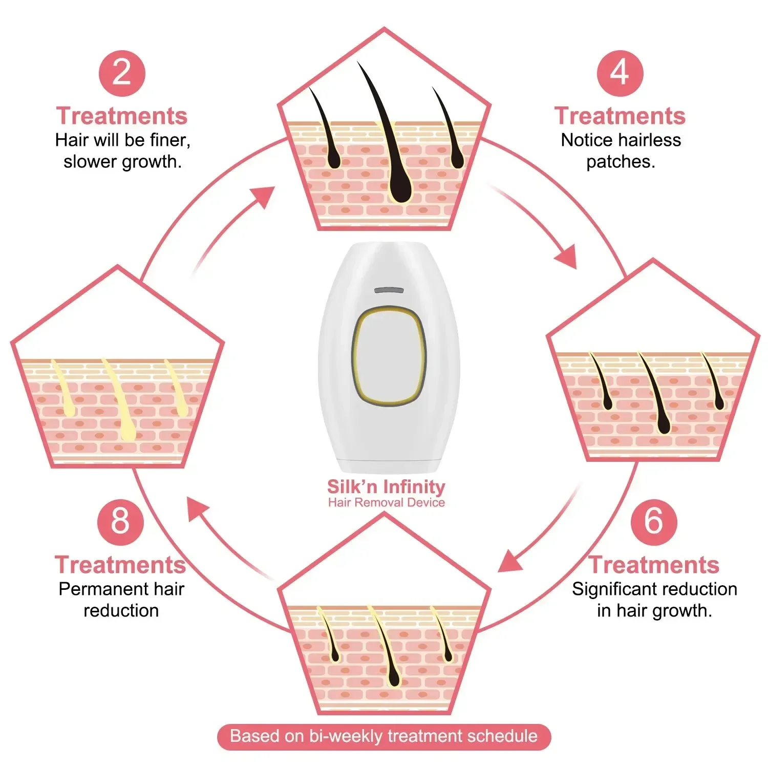 Ipl Laser Haarentfernungsgerät Für Gesicht Und Körper Epilierer_voghion.com