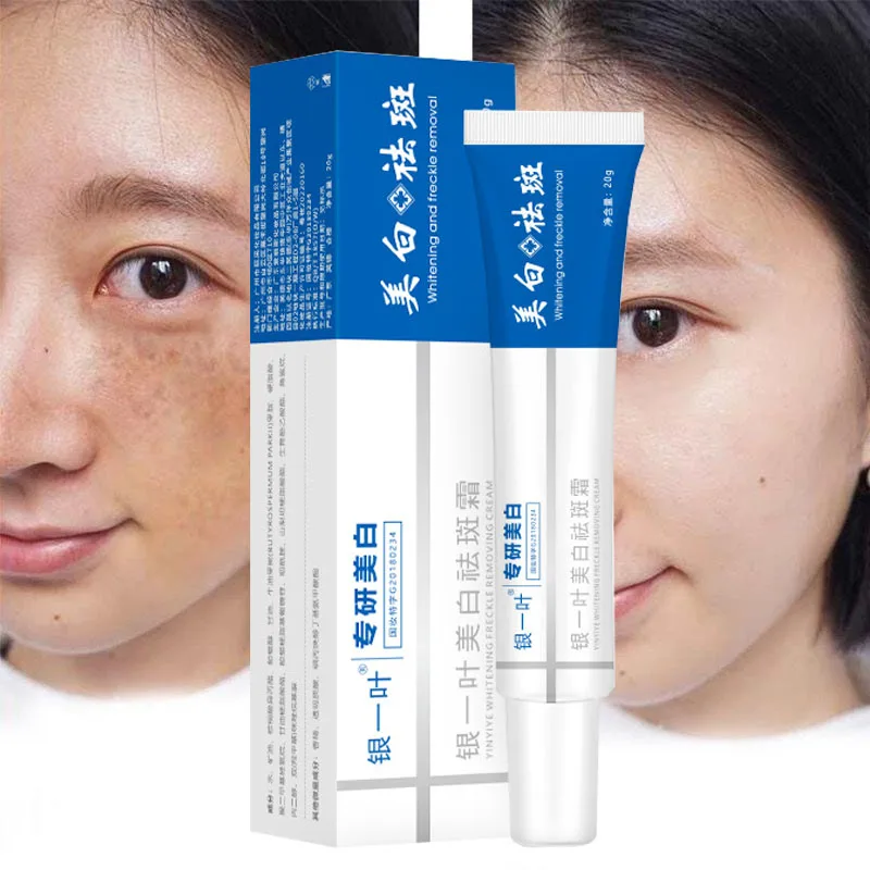 

Whitening Freckle Cream Remove Dark Spots Cream Nicotinamide Fade Melanin Moisturize Brightens Skin Tone Face Skin Care Products