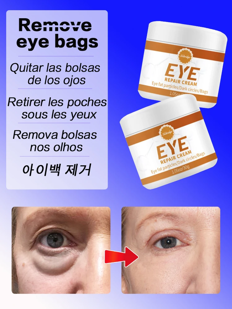 

Мешки для глаз, крем для удаления морщин вокруг глаз